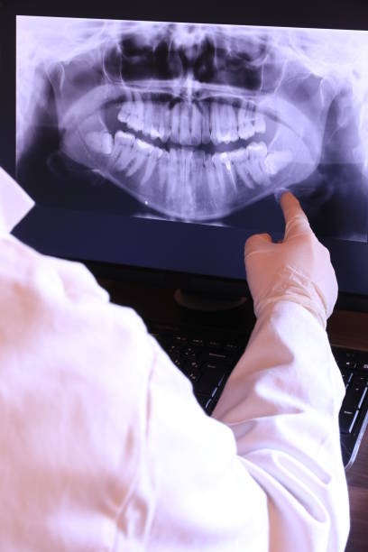 Best Knocked-Out Tooth Emergency  in Kodi Station, AK